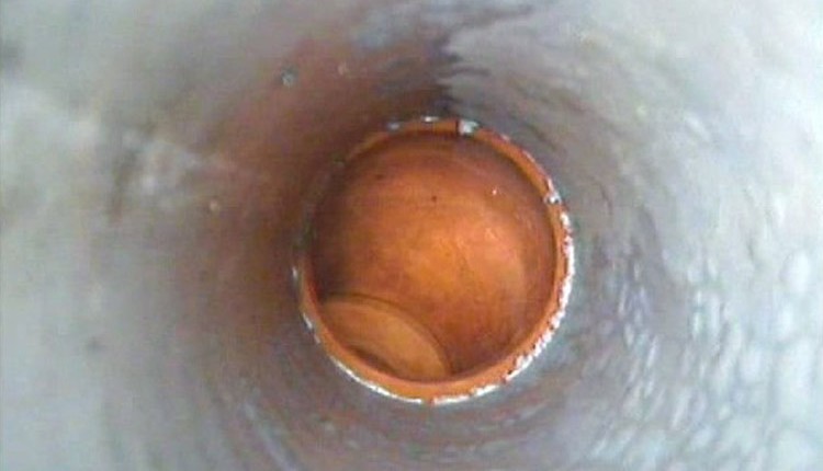 endoscopia saluteambietne