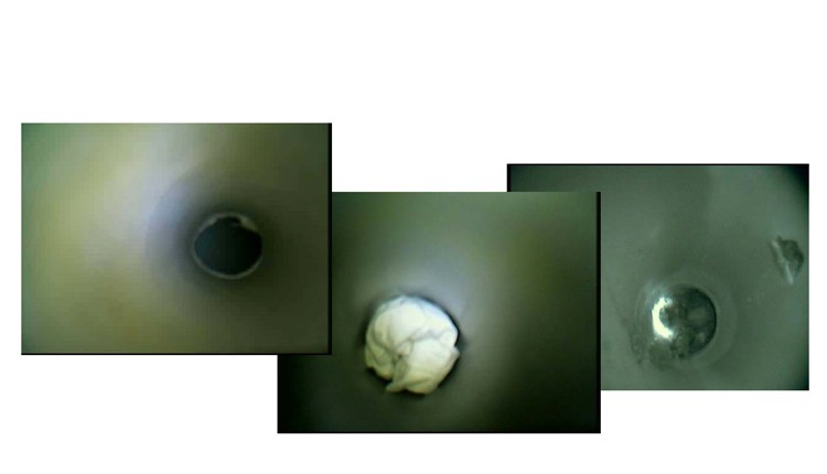 endoscopia video termografia salute ambiente como lecco